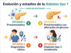 Evolución y estadios de la Diabetes Tipo 1